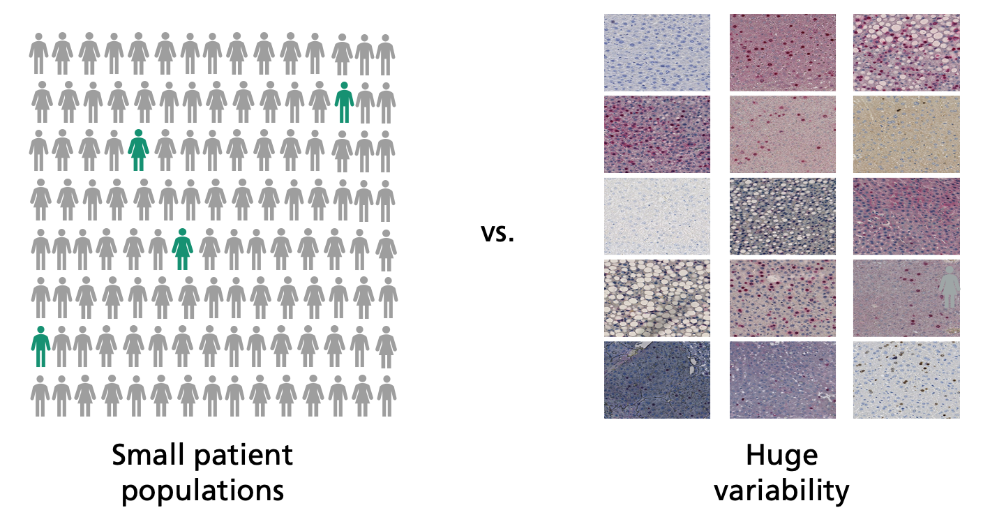 Small populations in clinical trials face the large variability in histological data.