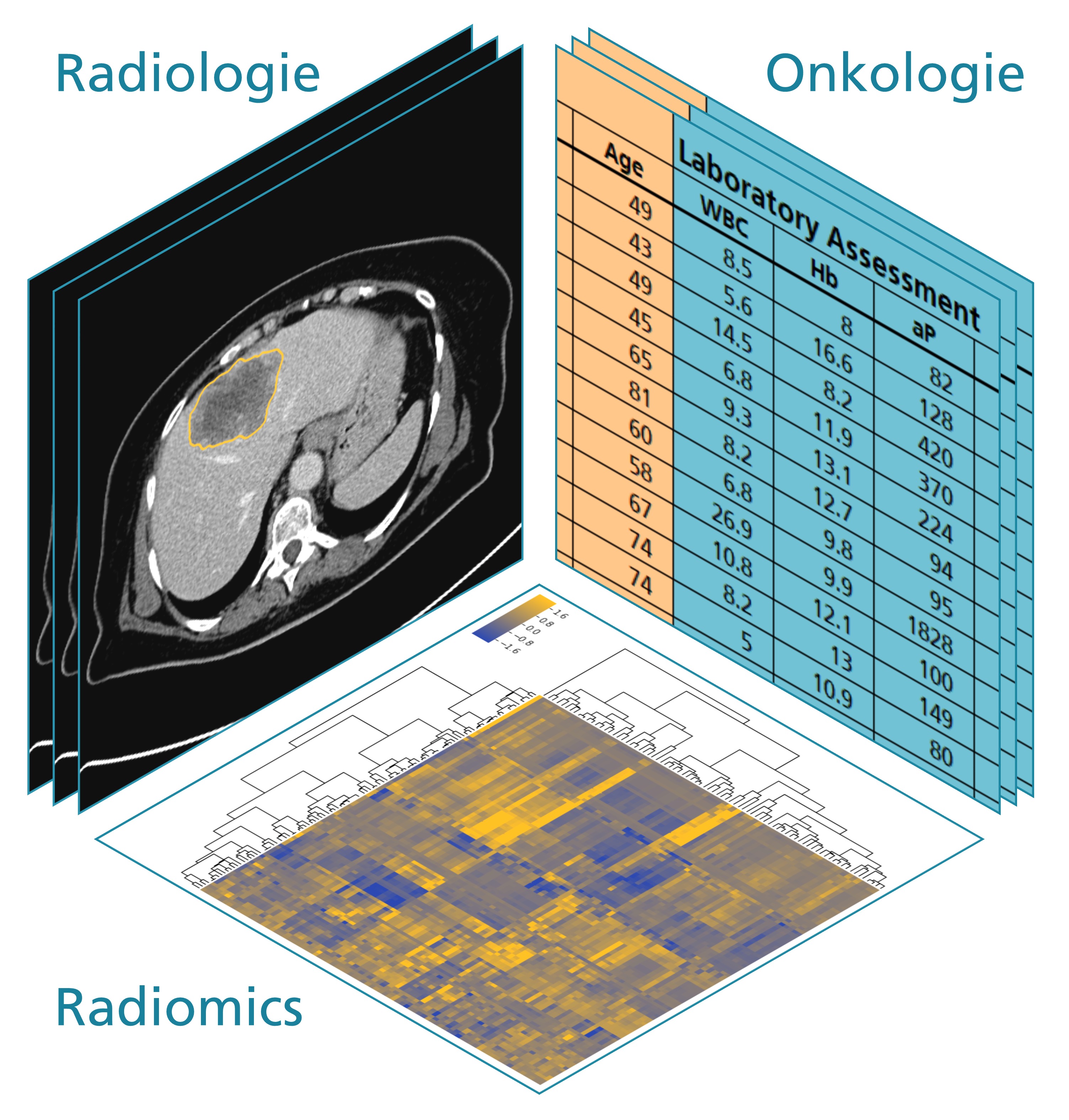 CT-Bild, Tabelle mit klinischen Parametern und Heatmap, die deren Korrelation zeigt.