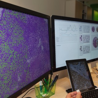 Fraunhofer MEVIS Softwarelösungen