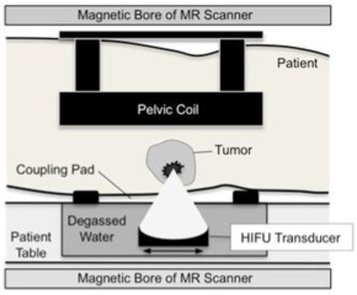 Magnetlager MR Scanner Becken Spule