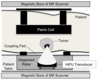Magnetlager MR Scanner Becken Spule