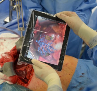 iPad in der Leberchirurgie