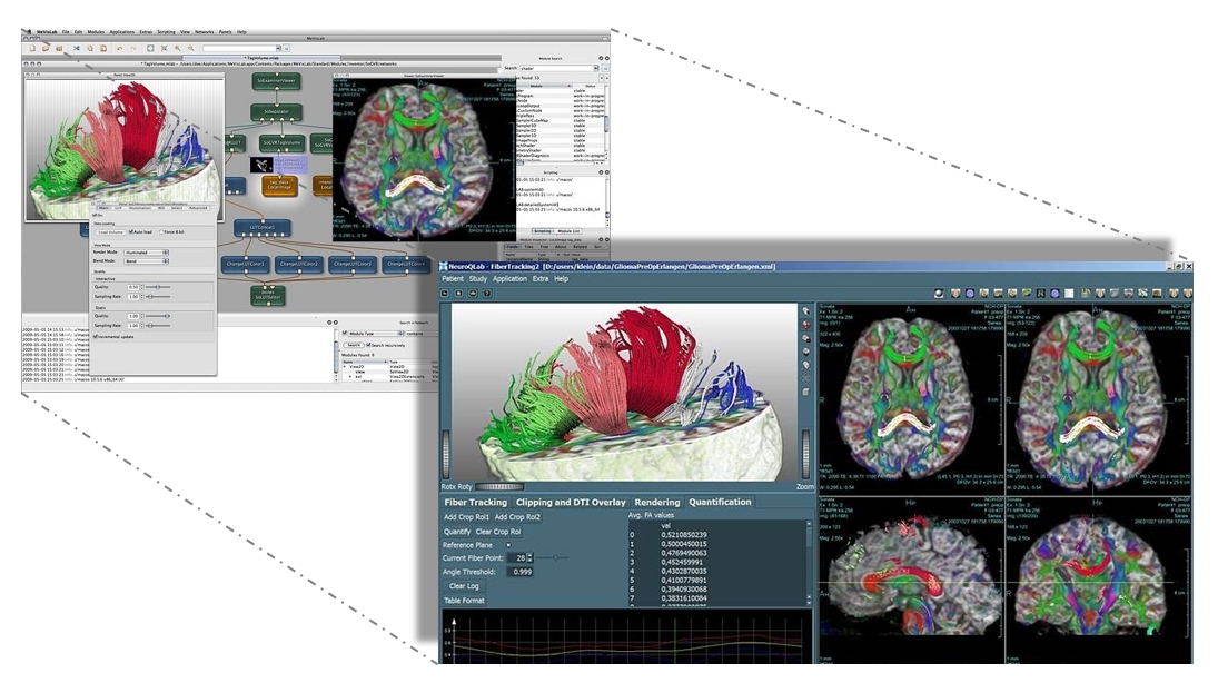 MeVisLab Software-Oberfläche