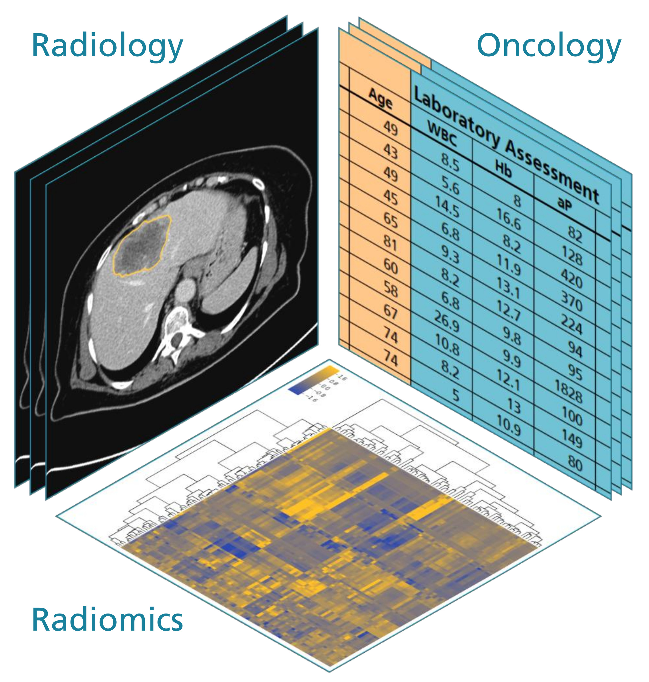 CT-Bild, Tabelle mit klinischen Parametern und Heatmap, die deren Korrelation zeigt.