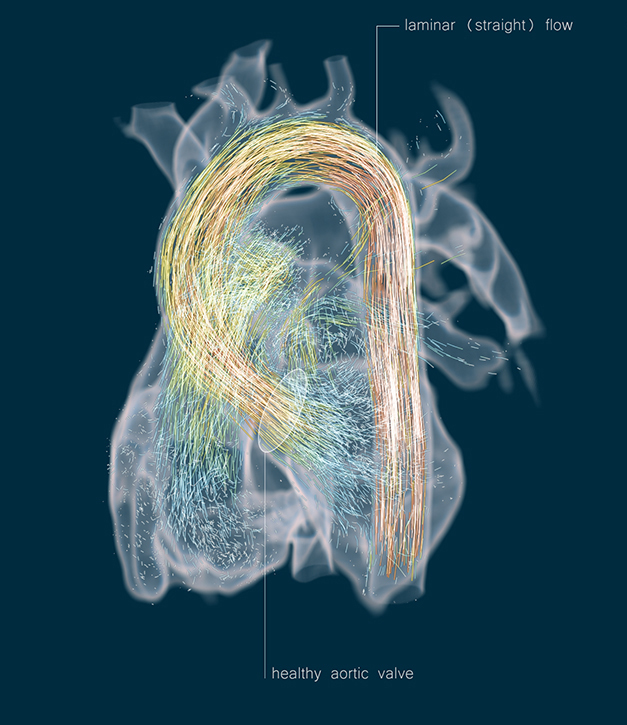 Finite element methods simulate tissue deformation for orthopedics and soft tissue. Simulating heat distribution helps determine necrosis during radio frequency ablation. Lesion detection, tumor characterization, and automated risk structure segmentation for risk analysis help decide between treatment and therapy options, plan the intervention, and derive scenarios for differential outcome analysis. 