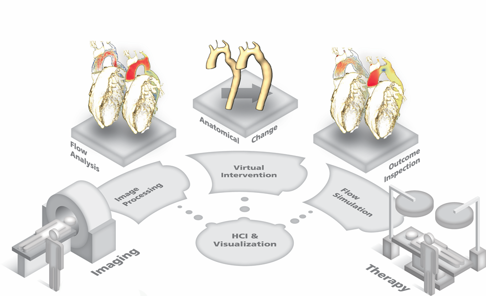 Our fast interactive simulation methods support the selection of the best device and placement strategy for each patient.