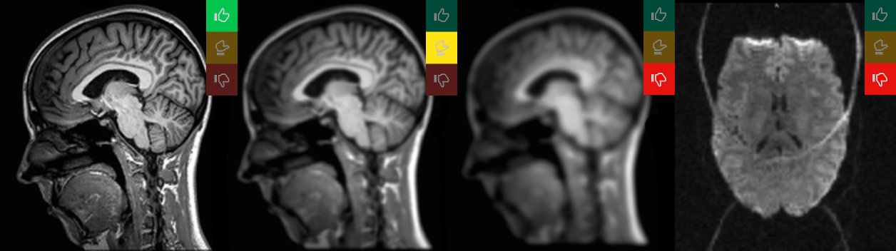 Automated quality assessment of MR image series.