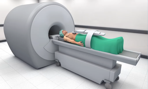 MR guided FUS Treatment of the Abdomen