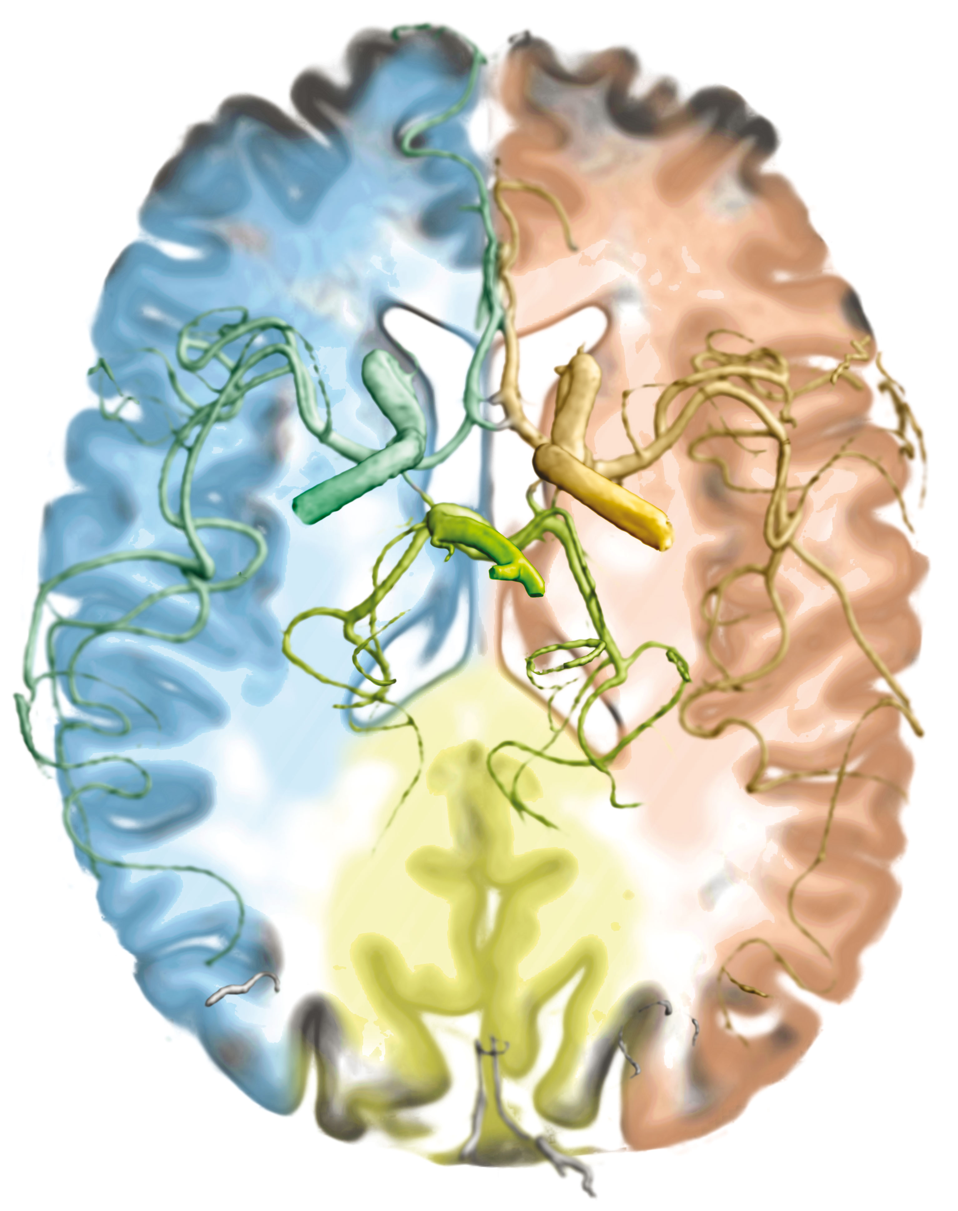 supply regions brain without contrast