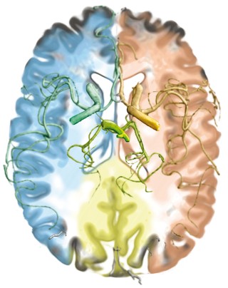 MRI supply regions of specific blood vessels