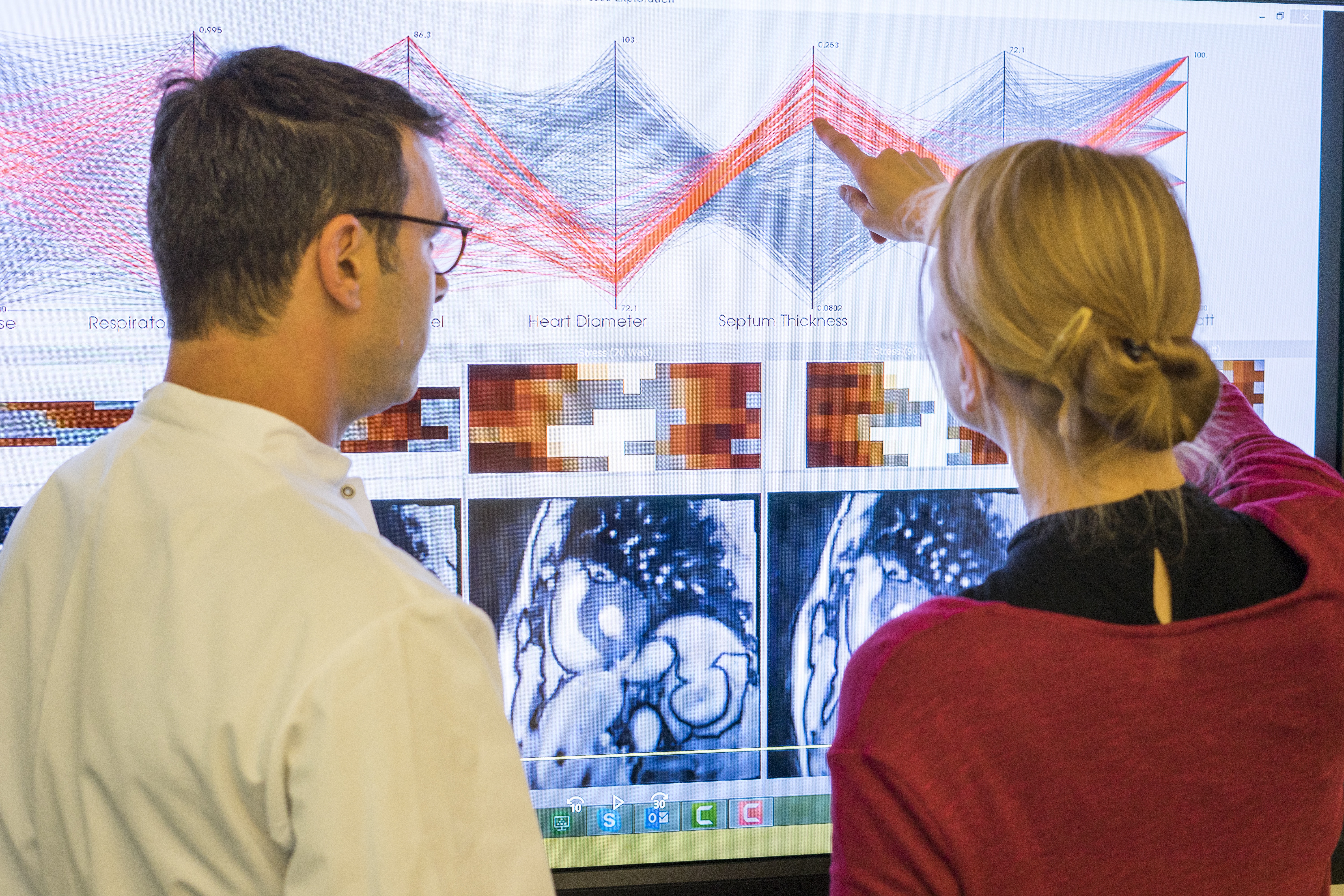 Inspection of the image-based geometric parameters describing the heart and its function. In patients with mitral valve insufficiency and altered pressure conditions the interplay of these parameters changes.