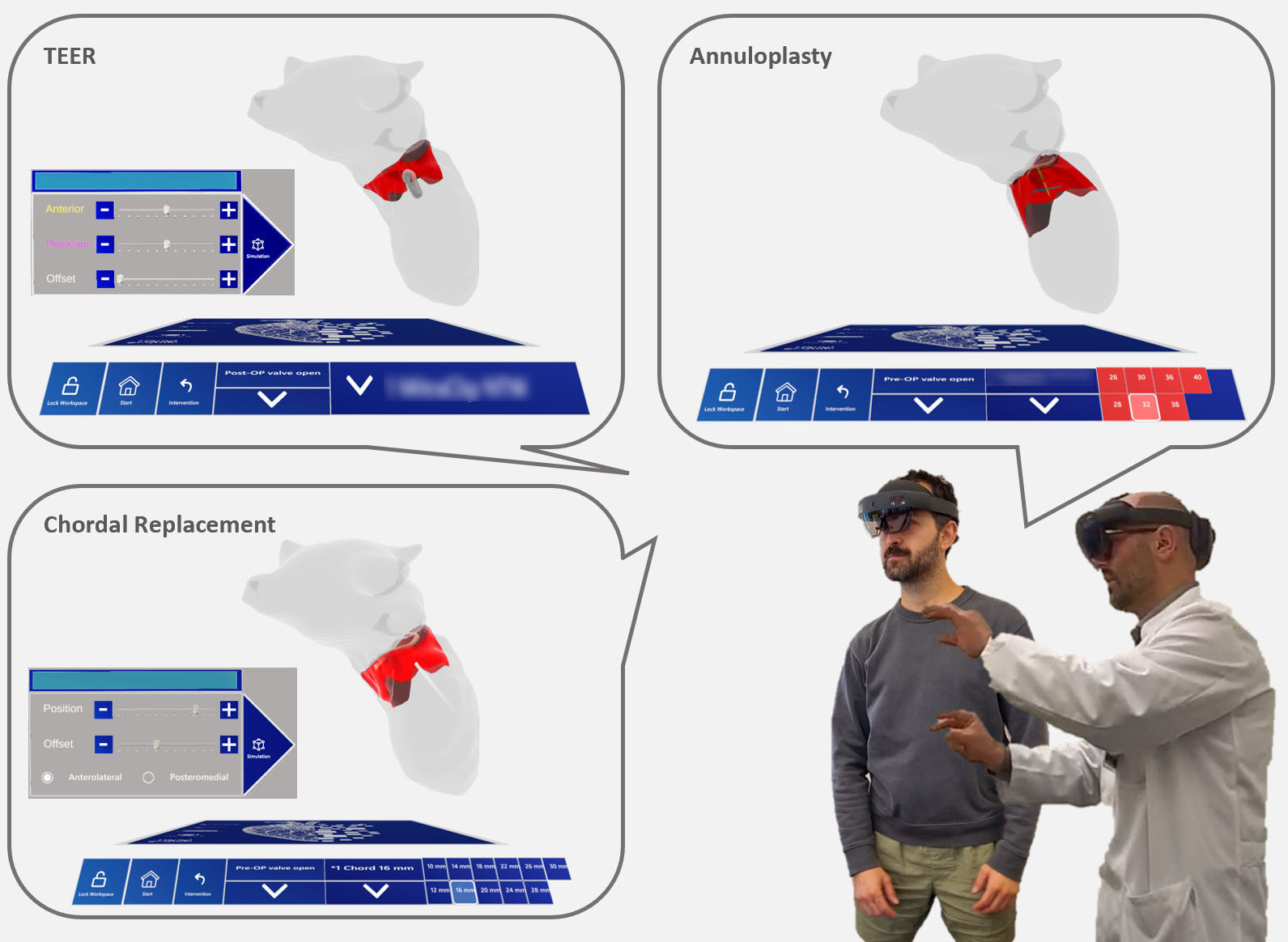 MINIMAKI: Mixed-reality-supported patient education and planning of heart valve interventions.