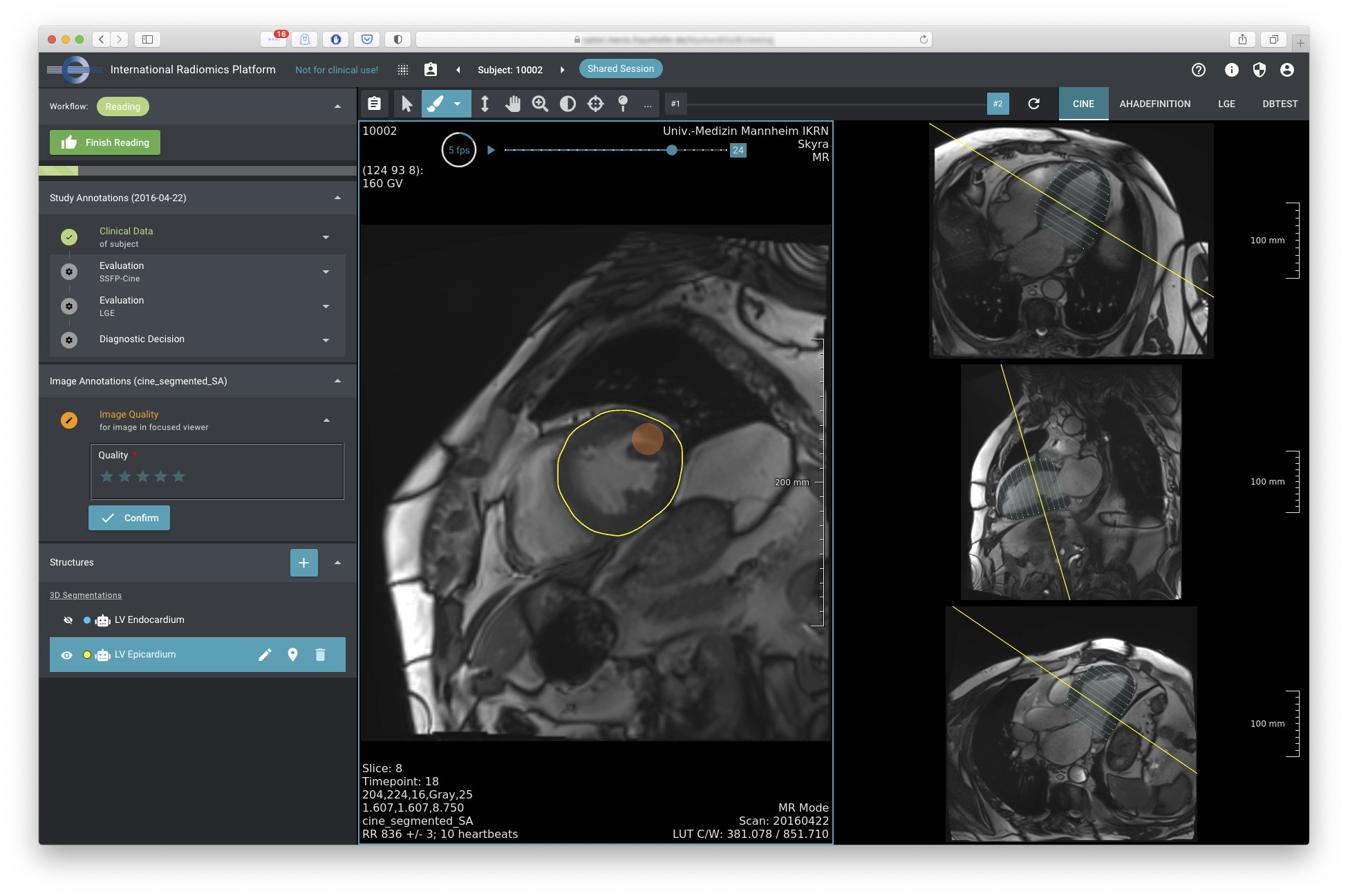Screenshot of a browser showing the SATORI application with various radiological images arranged next to a list of relevant clinical information and structures found in these images.