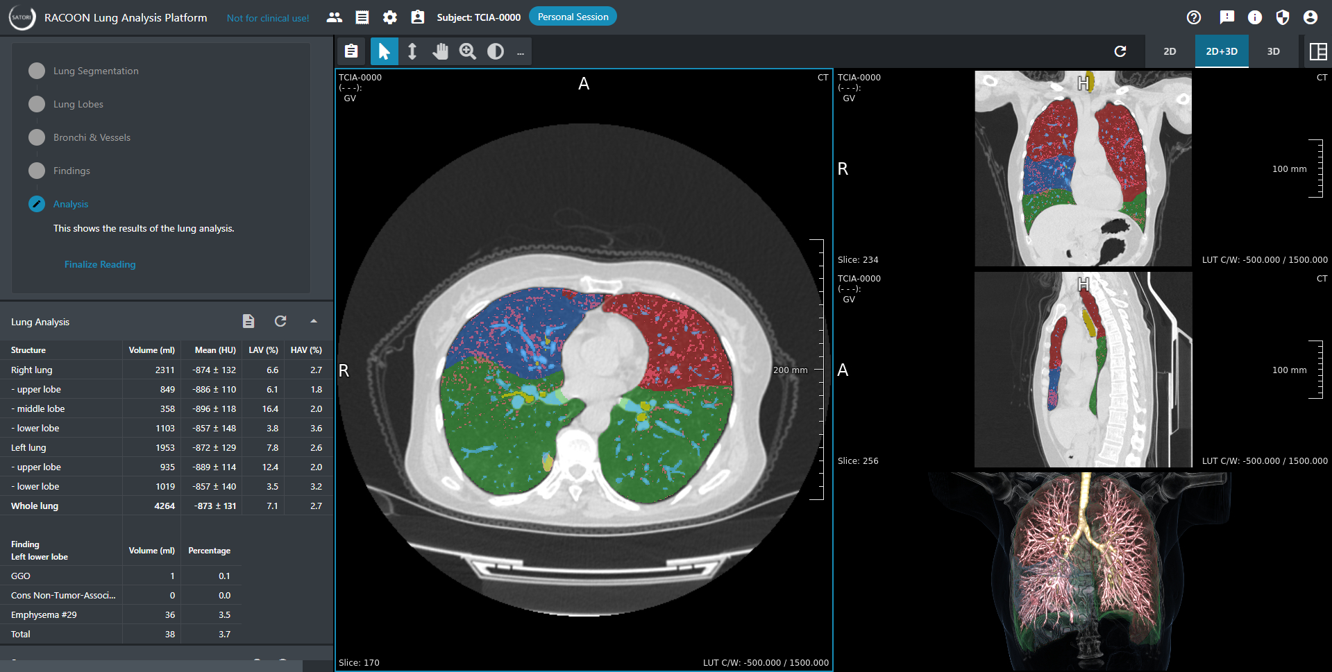 A SATORI configured for lung images shows a CT with analysis results and a 3D rendering of the lung