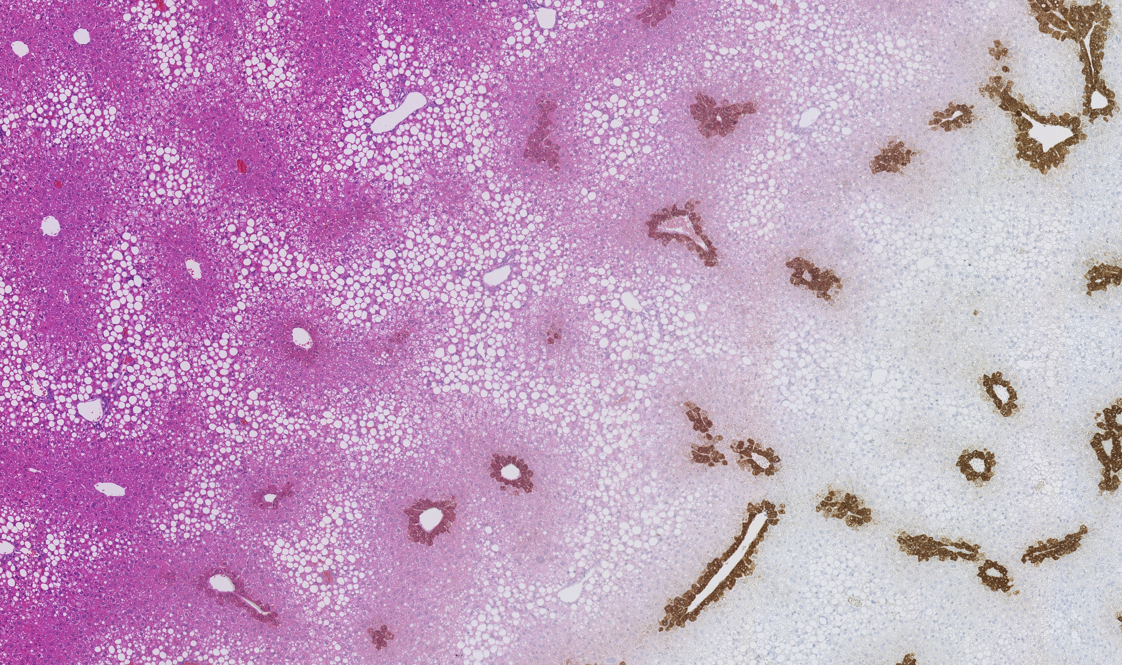 Liver Tissue Registration of Serial sections