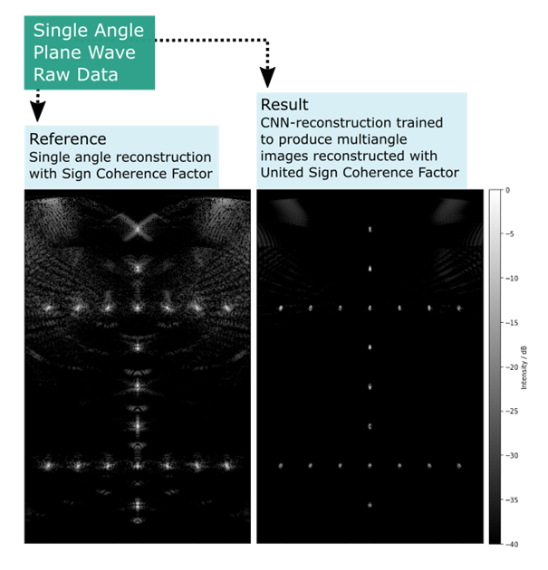 Deep Learning based ultrasound image reconstrucion may enable high quality image data from less input data.