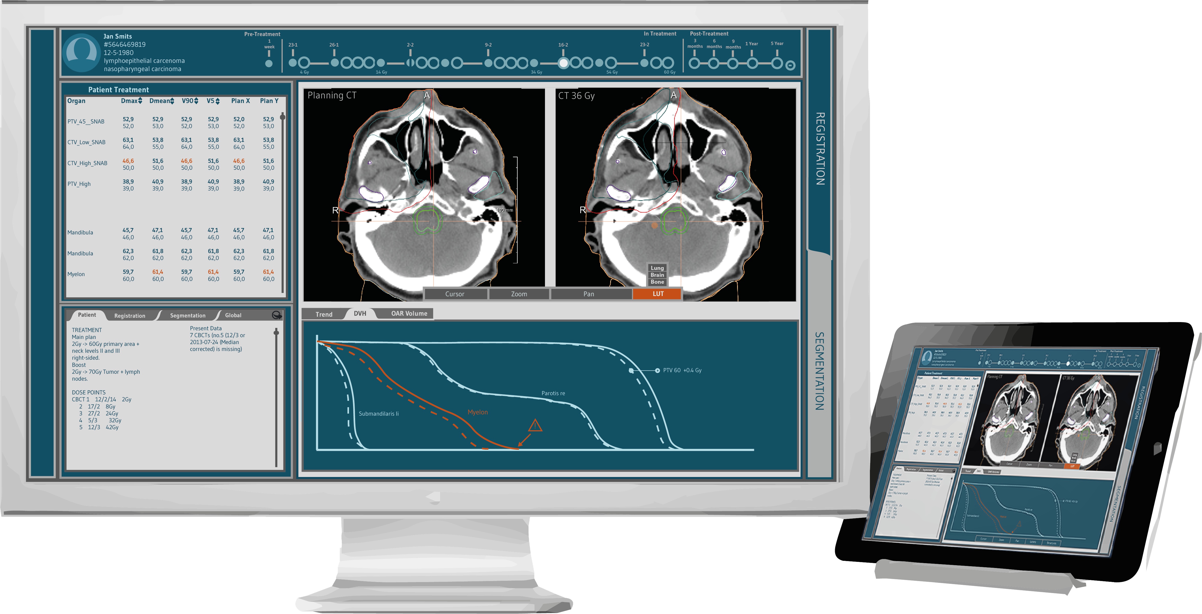 Treatment board application on screen.