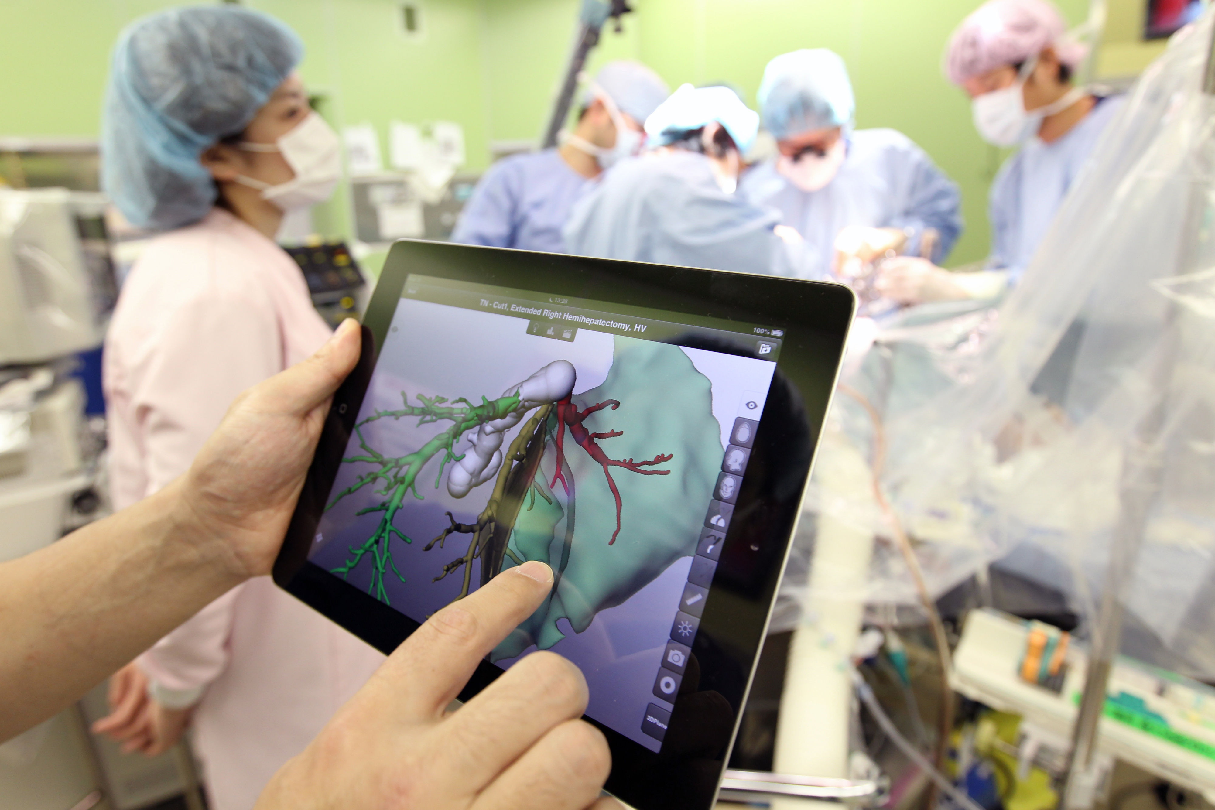 Moblile Tablet Application during a Liver operation
