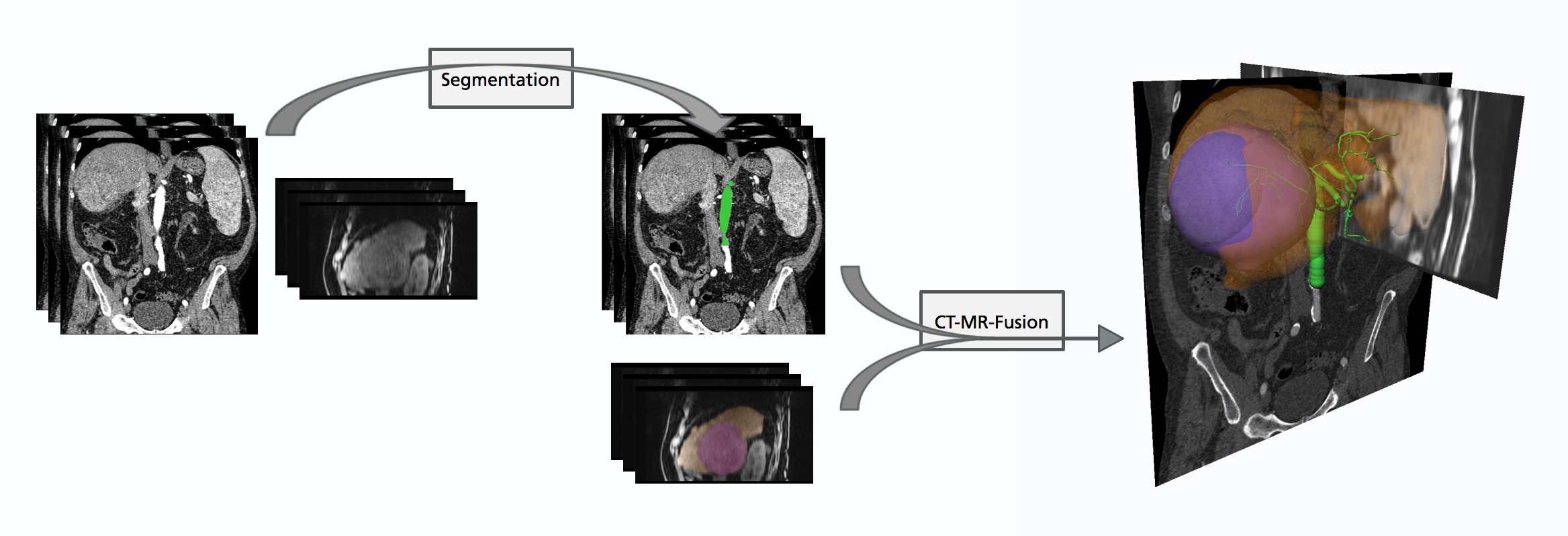 Image segmentation and multi-modal image registration.