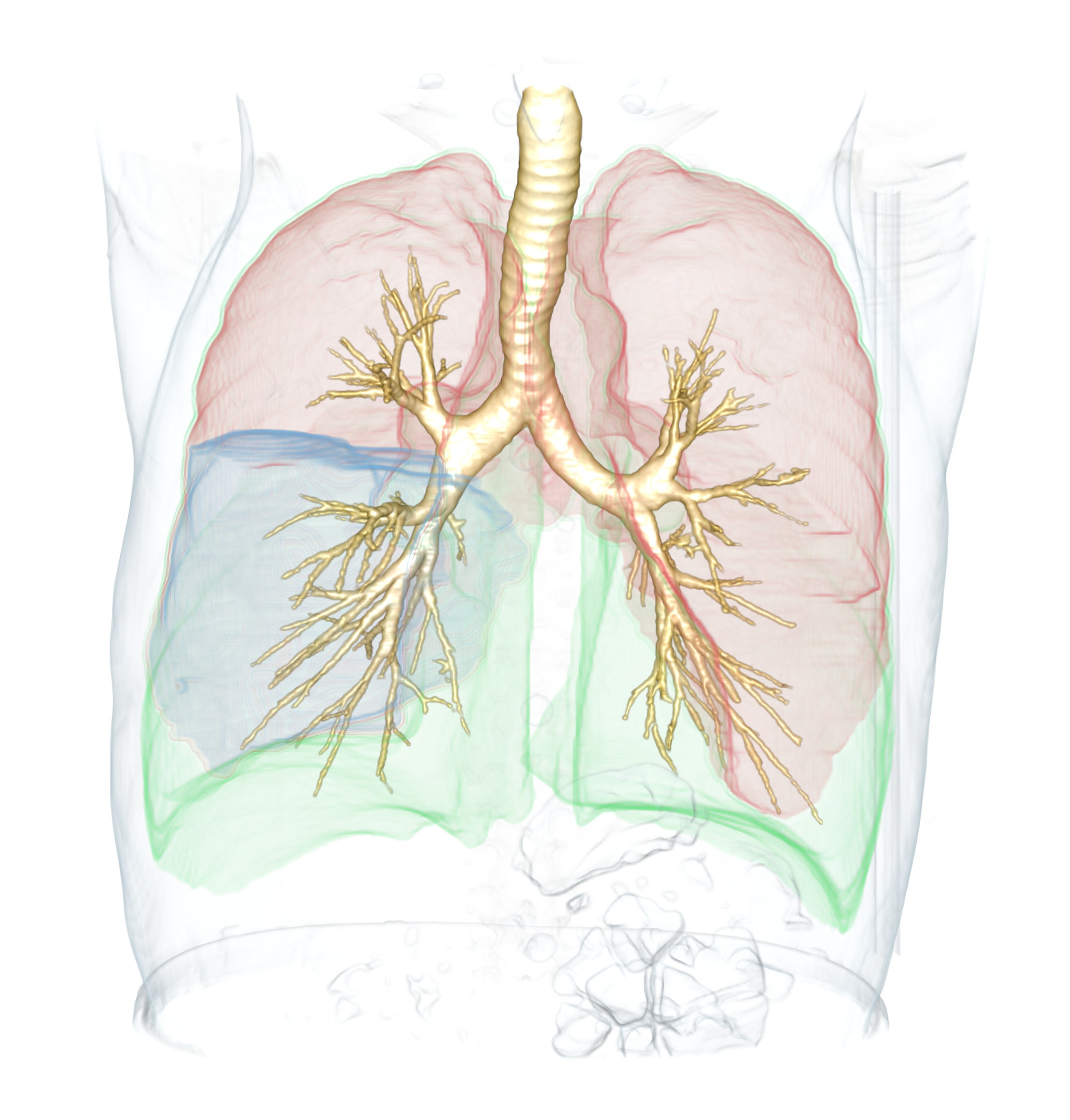 3D volume rendering of the segmented lungs, lobes, and airways.