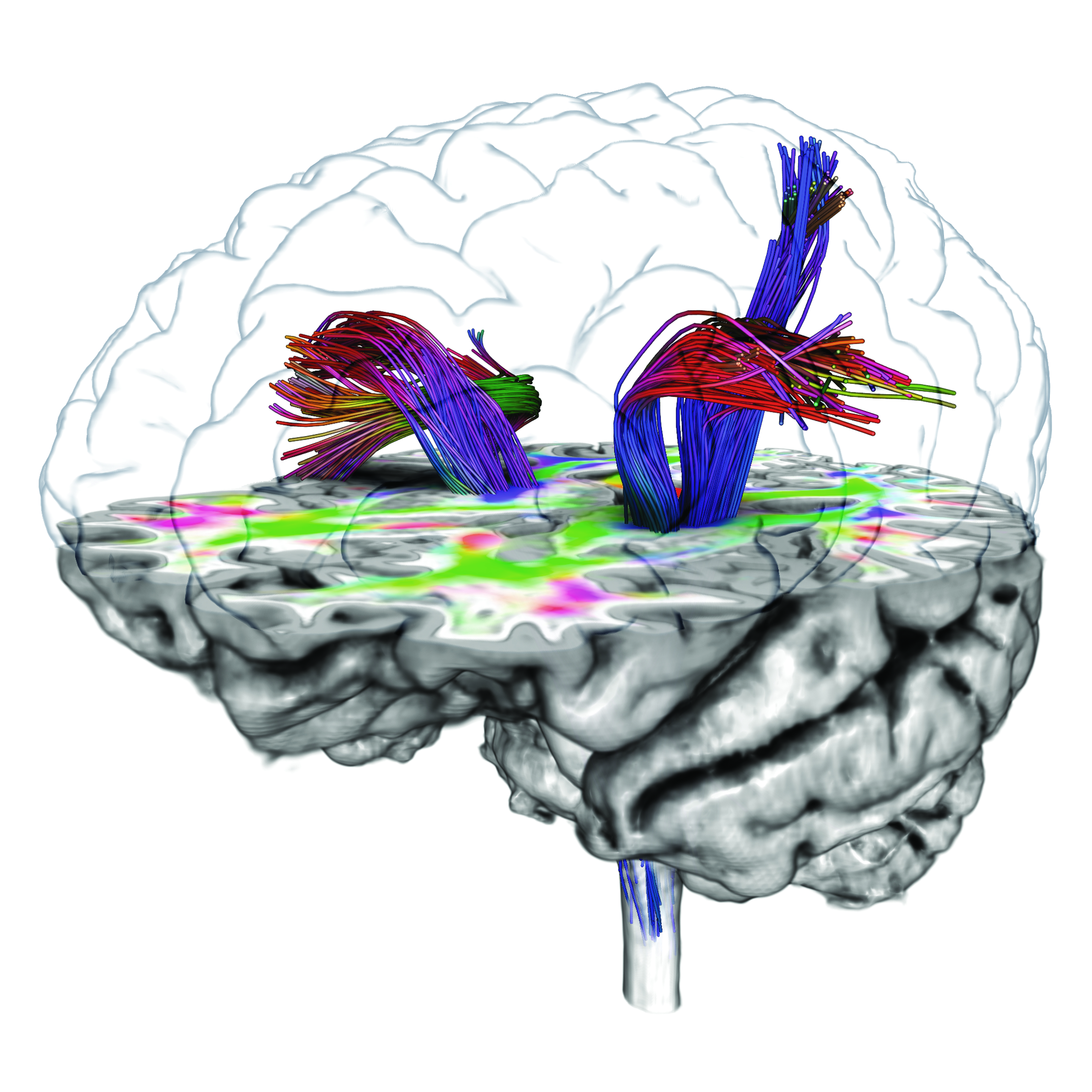 Volume Rendering brain fiber tracts