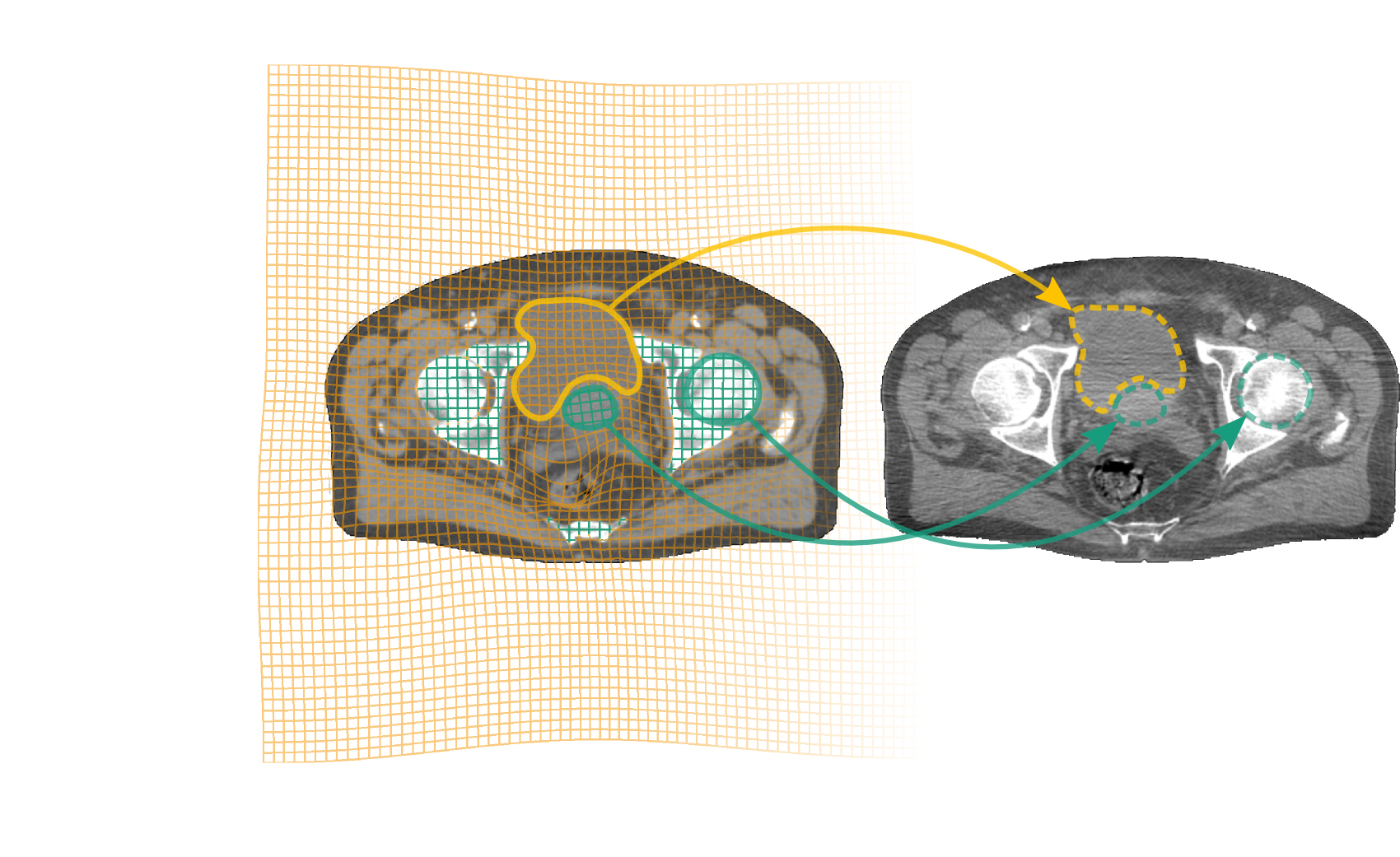 Registration with local rigidity constraints